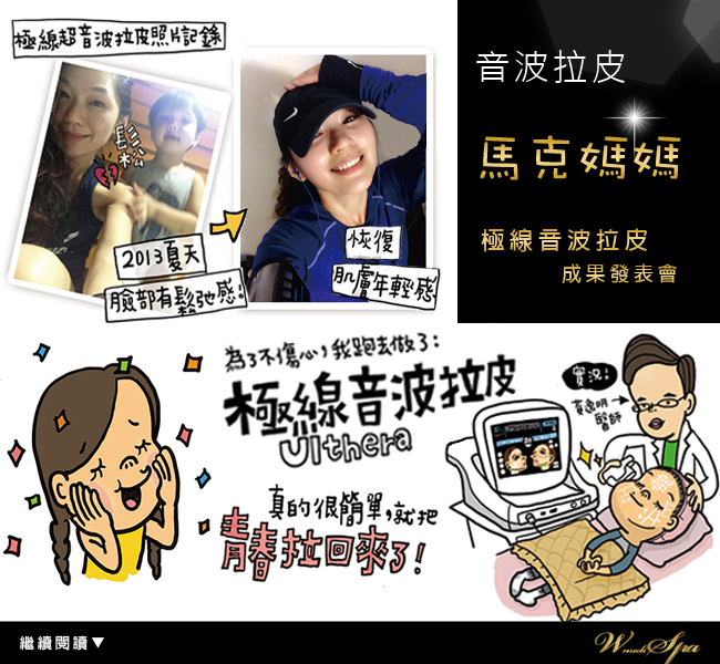 sharing-1876-thumbnail